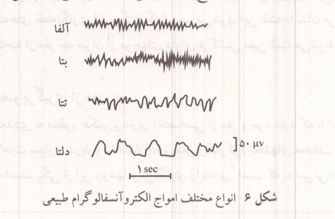 انواع مختلف امواج الکترو آنسفالوگرام طبیعی